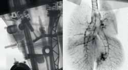 Röntgenaufnahmen eines Motorblocks und einer Rattenlunge